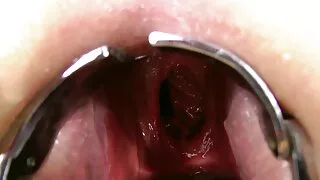 ડીઆરએસચ ગુજરાતી બીપી